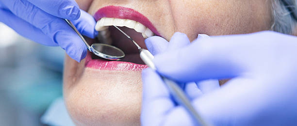 Best Emergency Dentist for Knocked-Out Tooth in Inverness, FL