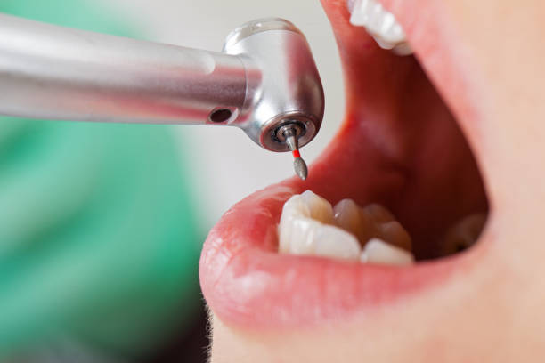 Best Broken or Cracked Tooth Emergency Dentist in Inverness, FL